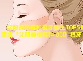 沈阳美格真种植牙医生TOP5谁更强「沈阳美格真种 🐳 植牙医生top5谁更强」